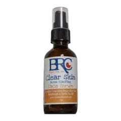 By Robin Creations Clear Skin Acne Blasting Face Serum