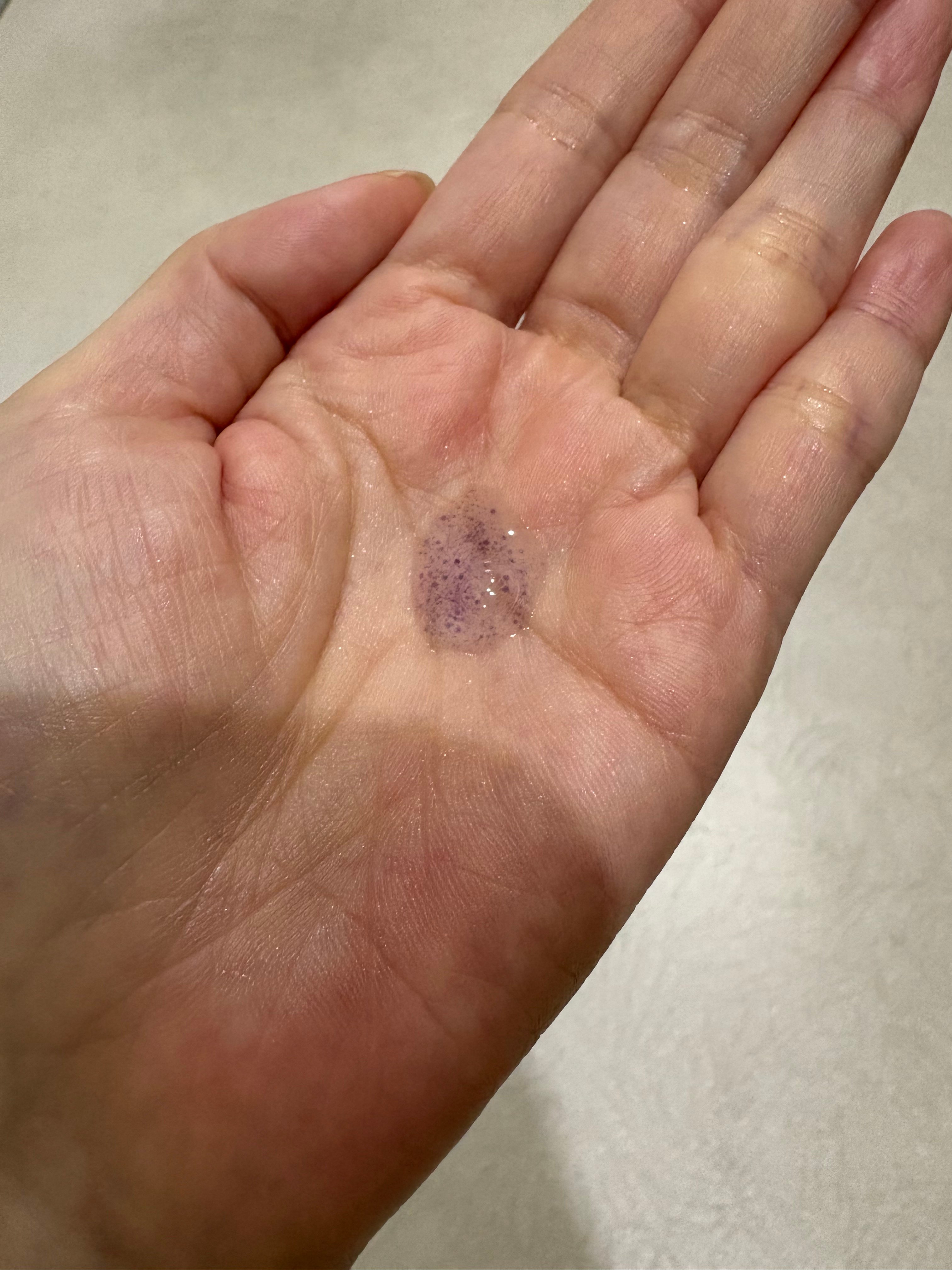 User review photo of MediCube Placenta Vita Serum