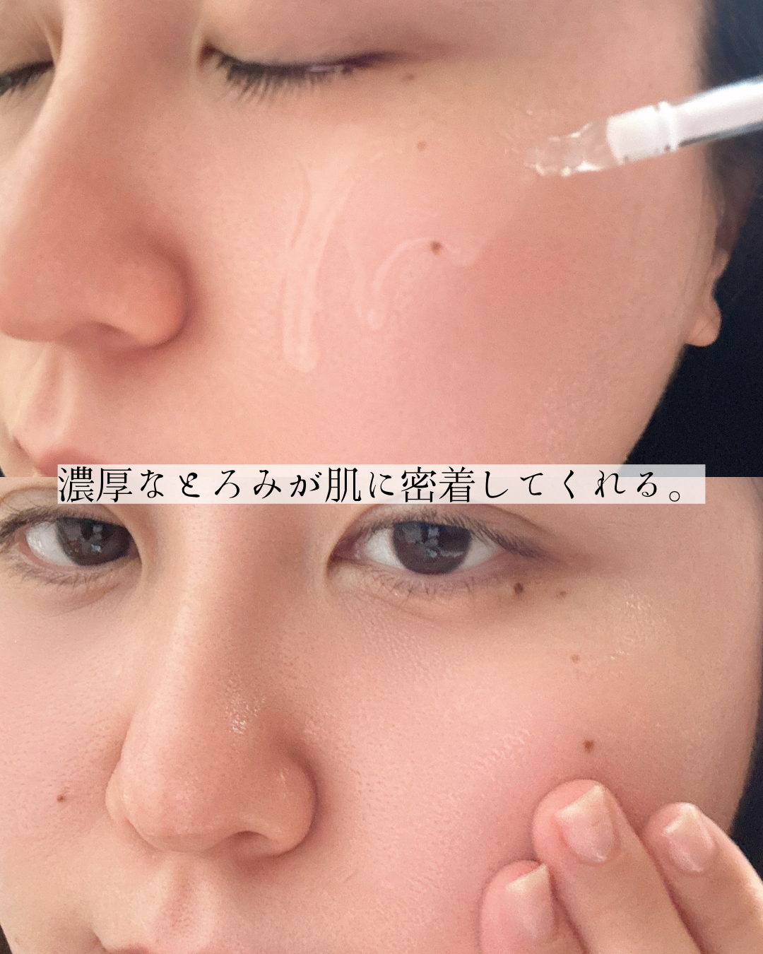 リジュラン デュアル エフェクト アンプルのユーザーレビュー写真
