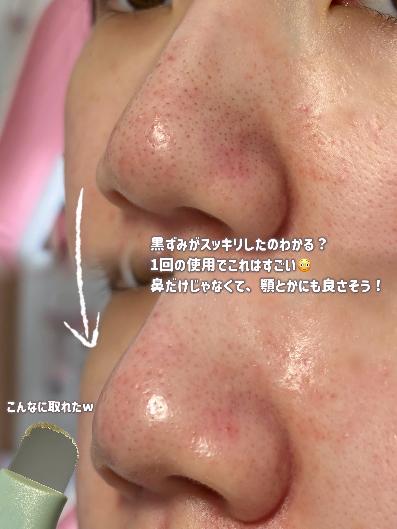Ilso スーパー メルティング セバム ソフナーのユーザーレビュー写真