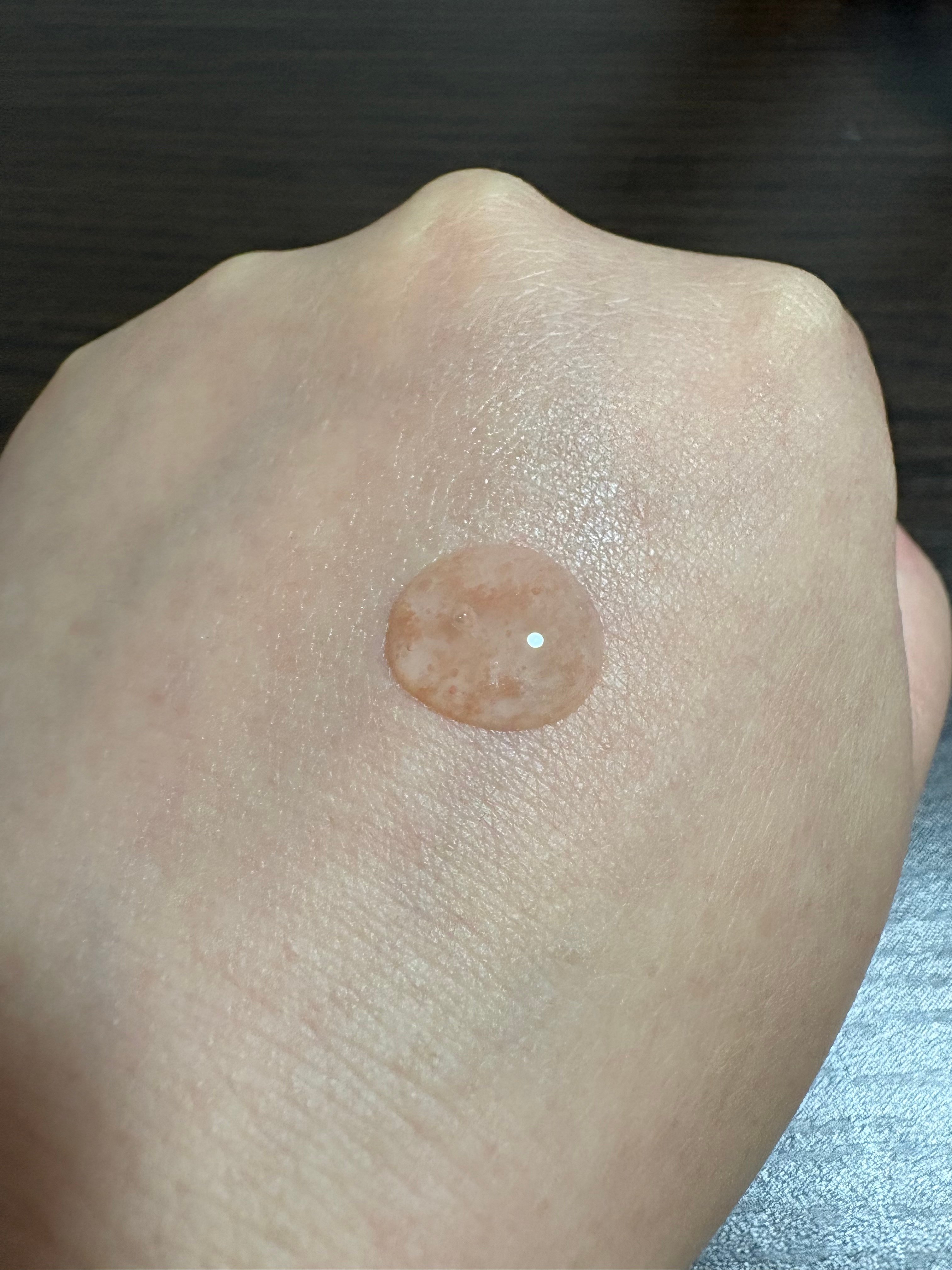 베네피크 세럼 사용자 리뷰 사진