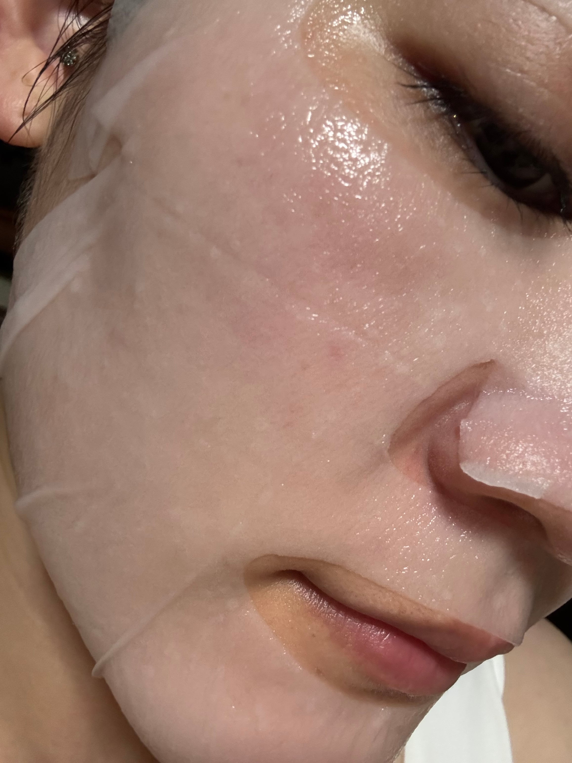 User review photo of Mediheal Derma Serum Mask PDRN