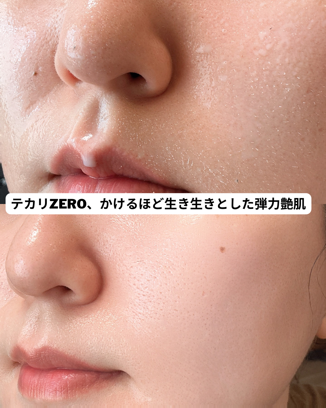 CNP Laboratory ダーマ アンサー スキン ブースティング セラム ミストのユーザーレビュー写真