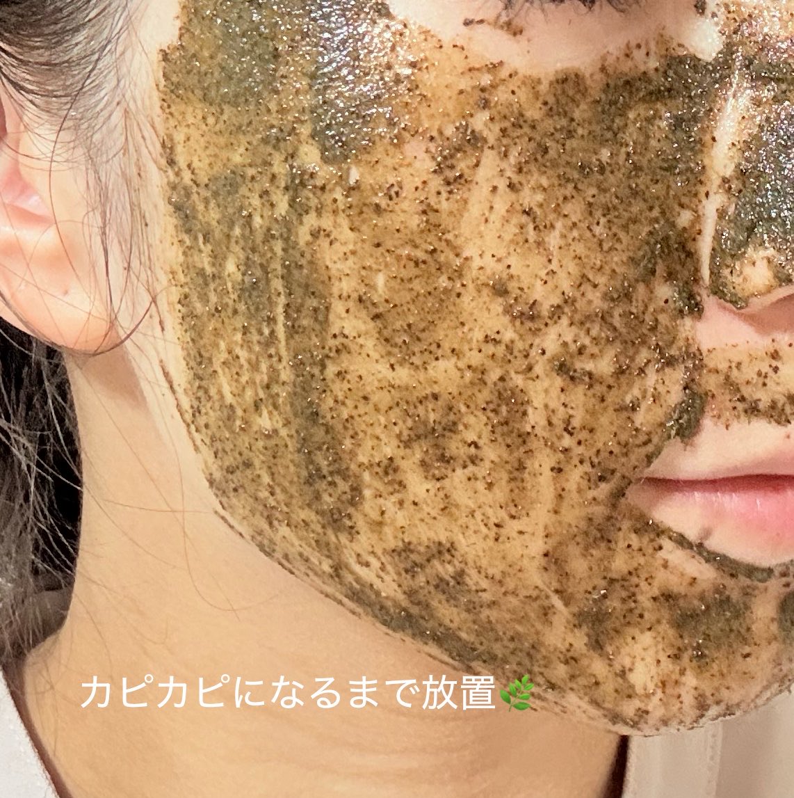 ウェルダーマ Chadew ティーツリー ハーブ トックス ピーリングパックのユーザーレビュー写真