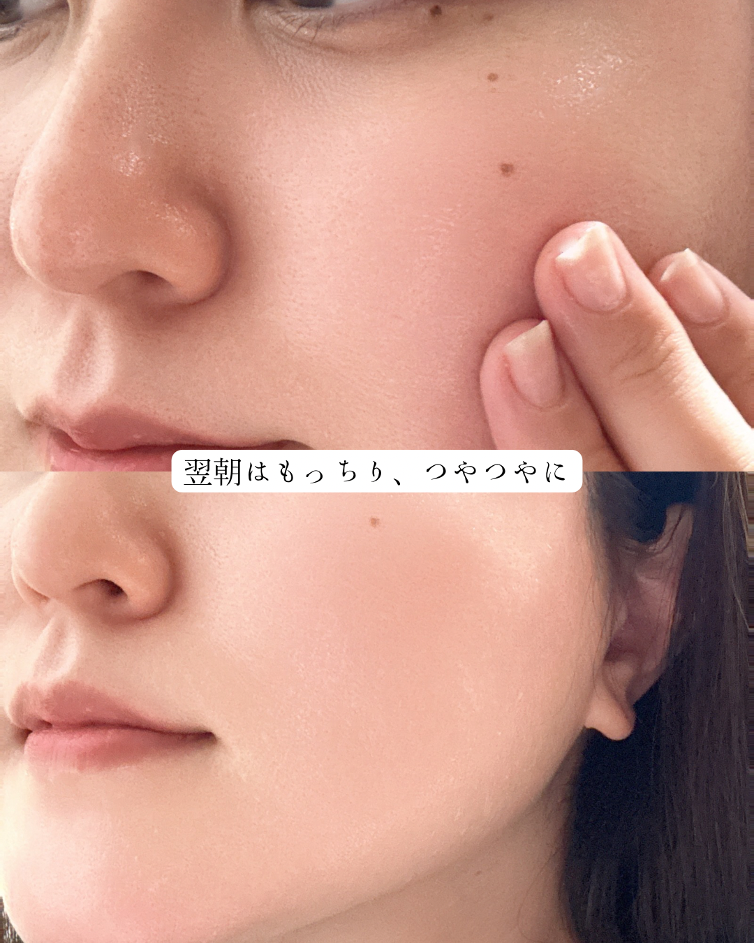 リジュラン デュアル エフェクト アンプルのユーザーレビュー写真