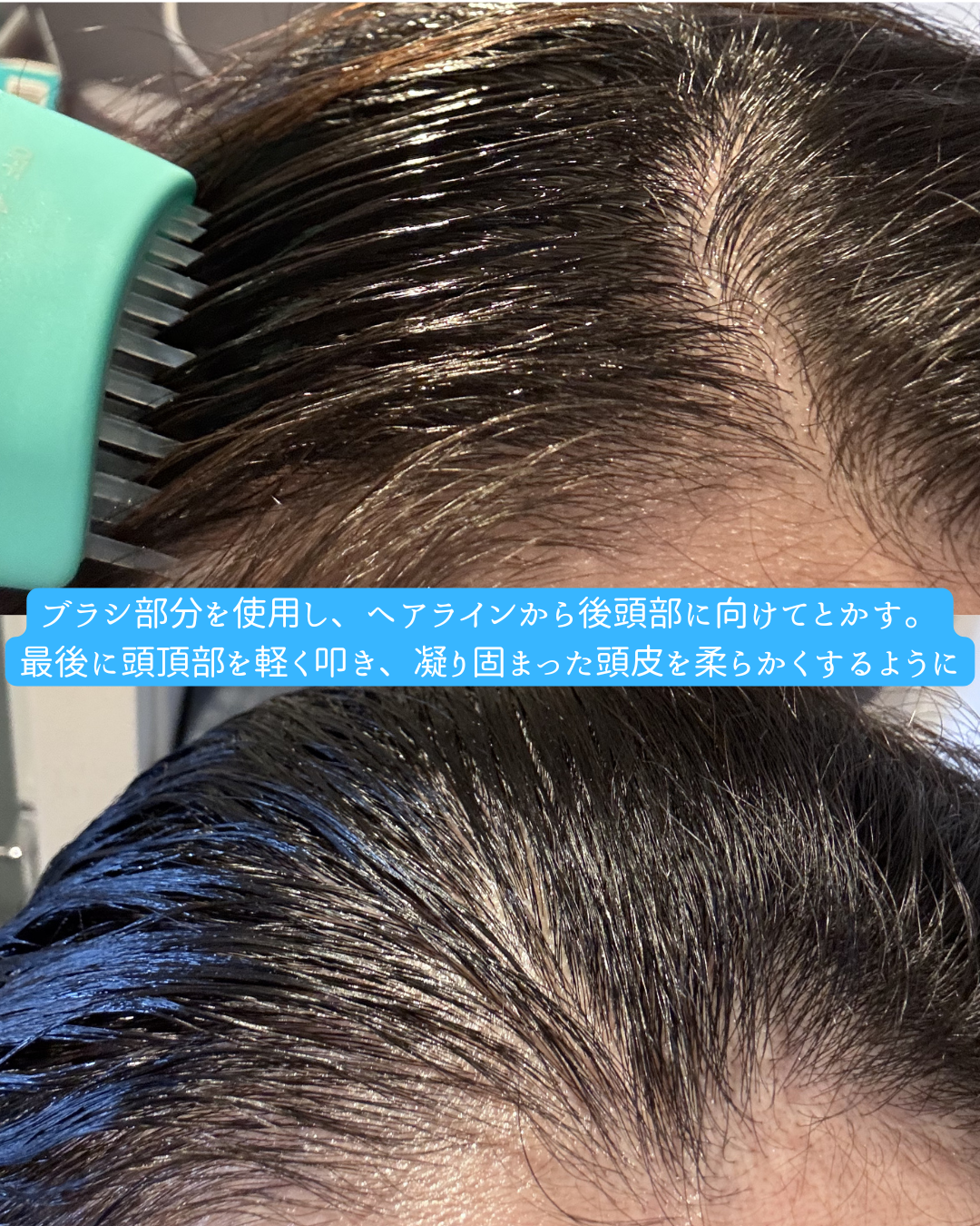 VTコスメティックス PDRN リードルショット ブラシ ヘアセラムのユーザーレビュー写真